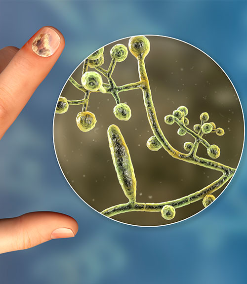 nail pathogen panel test